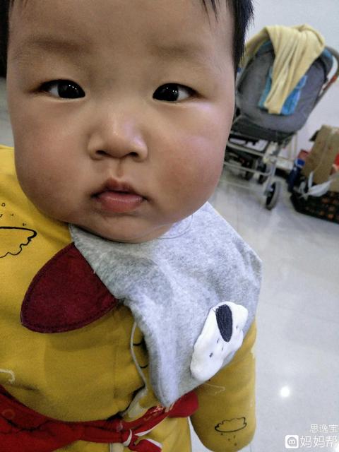 婴儿眼睛对眼