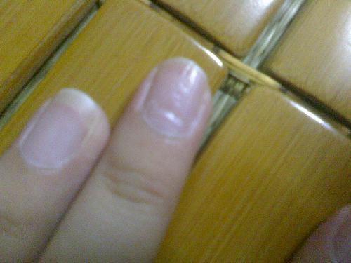 4岁宝宝指甲凹凸不平是什么原因