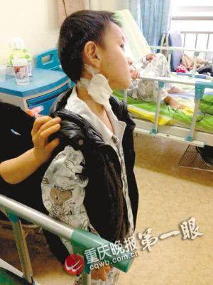 涛涛颈部被钢珠射入留下伤口