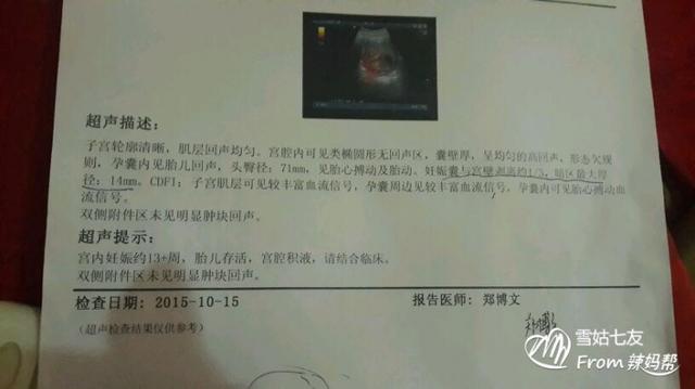 什么原因造成孕妇胎盘早期剥离