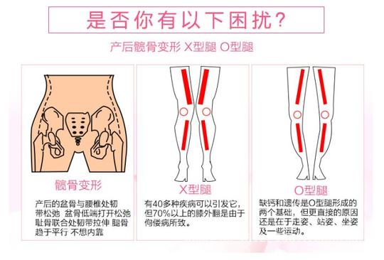 髋骨调理仪产后恢复美容仪器美容院家居通用仪器