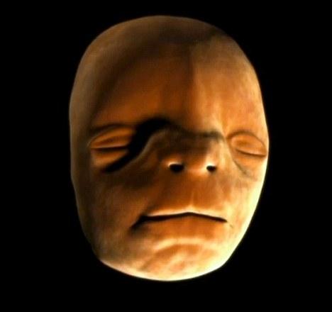 孕妇怎么判断胎儿是否发育正常
