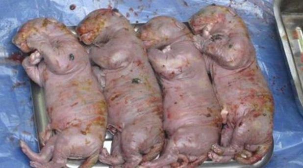 怀孕后肚子会变黑怎么回事