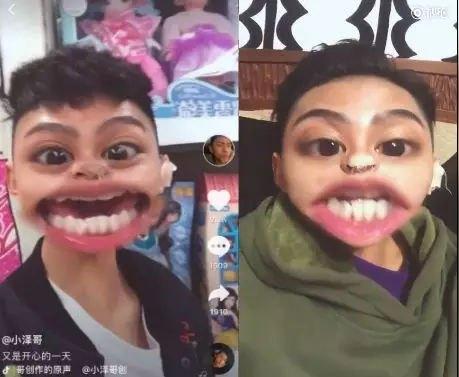 抖音彭于晏做了个隆鼻,变成了3个鼻孔?