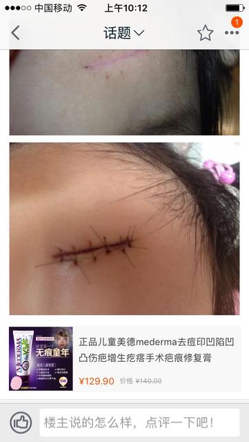 孕妇是疤痕体质可以选择剖腹产吗