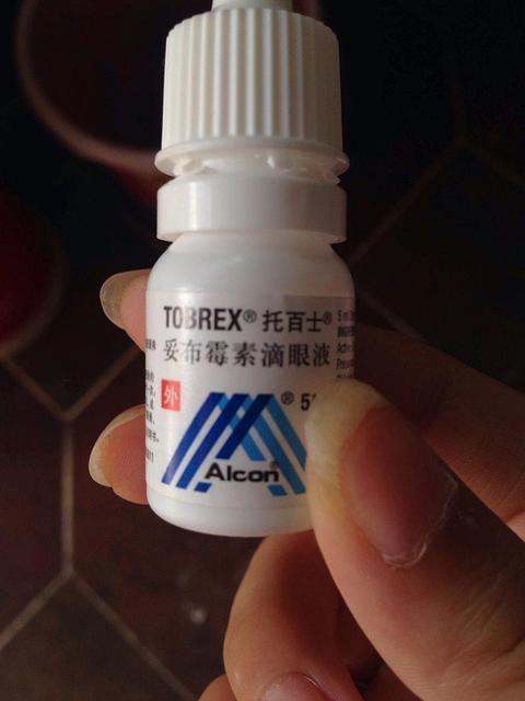 新生儿眼睛有黄眼屎是怎么回事