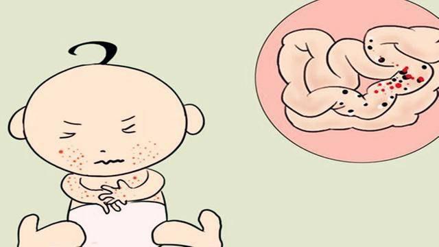 八个月宝宝吃鸡蛋过敏的症状