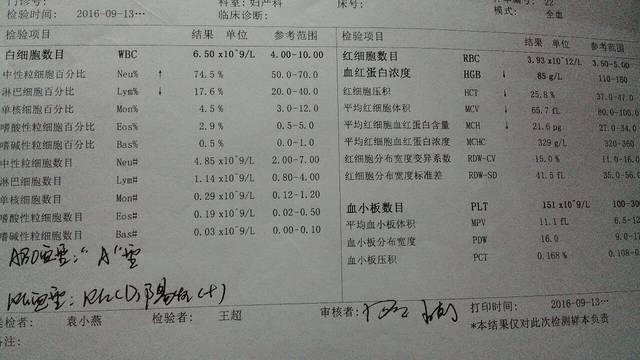 婴儿判断贫血的指标