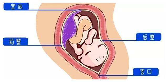 胎盘在前壁比较显怀吗