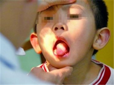 宝宝舌系带短是什么原因造成的