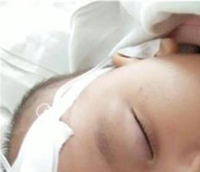 孩子发烧了可以进行推拿退烧吗