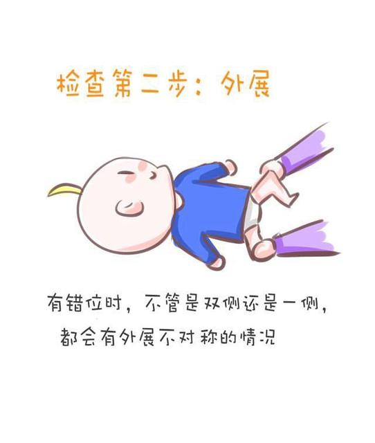 婴儿臀纹不对称一定是髋关节脱位吗