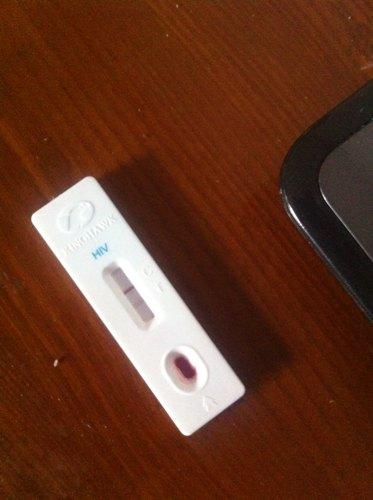 孕期hiv阳性怎么办