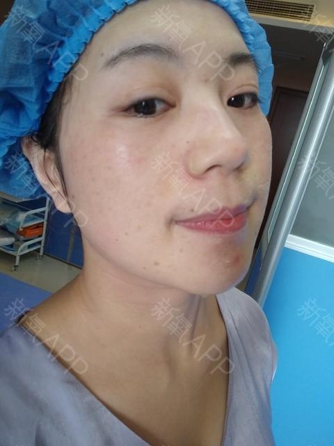 孕妇每天上班对着电脑对胎儿有影响吗
