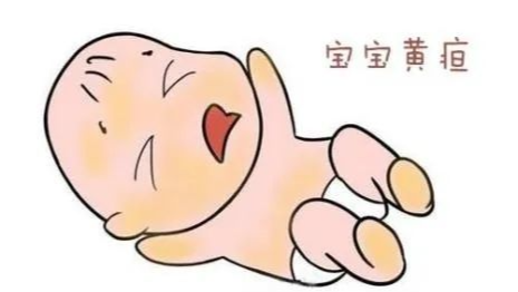 小儿黄疸怎么办?