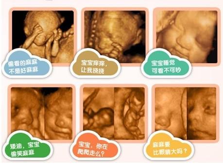 四维彩超多少钱啊