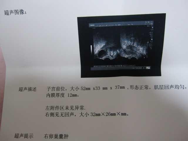 卵巢囊肿大了有什么危害