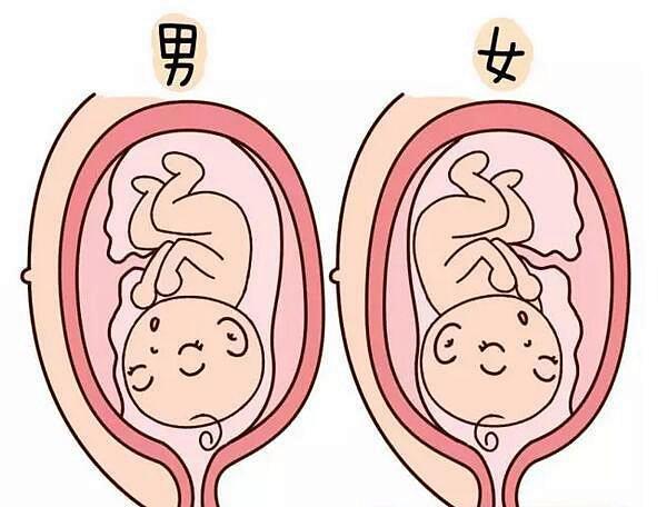 胎盘前壁胎儿图图片