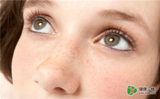 产后有黄褐斑怎么消小妙招