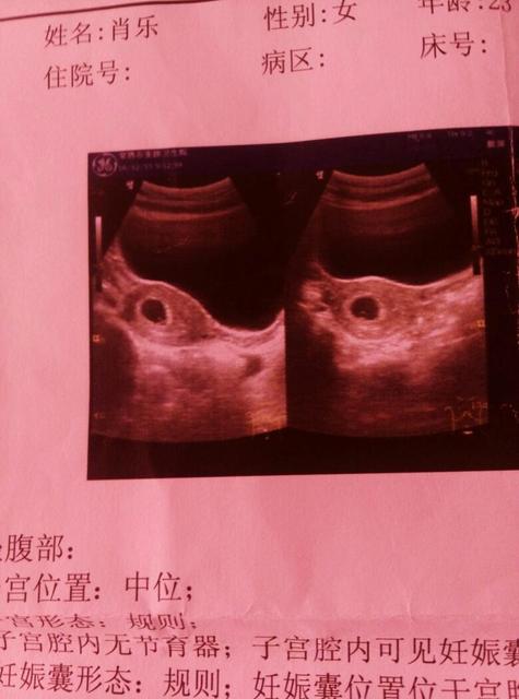 三个月的胎儿有多大