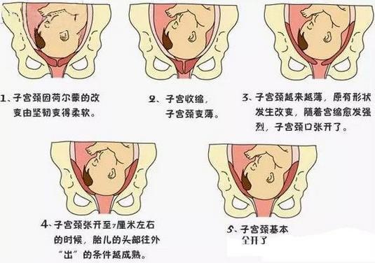 胎儿入盆时有什么感觉和症状