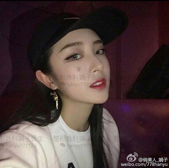 州俏美人微整形娟子的相册详情微女郎,微博美女创业,微博美女,
