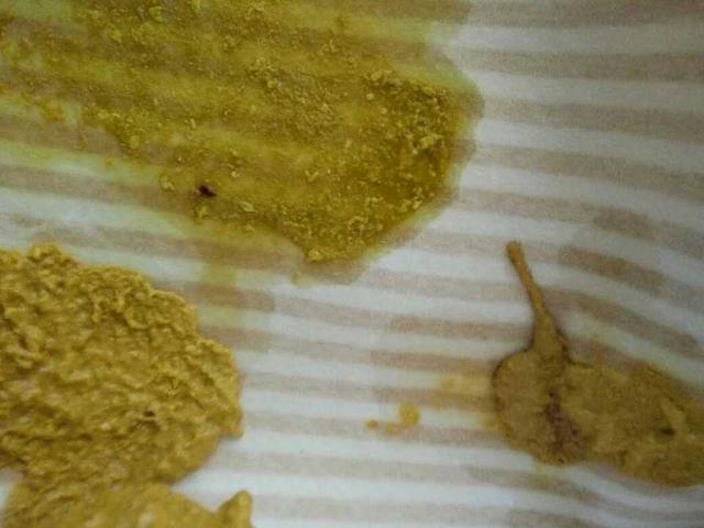 宝宝拉泡沫便便严重吗