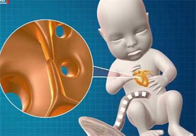 卵圆孔未闭合是什么意思?