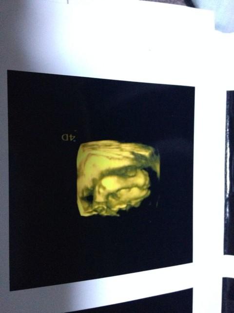 如何让宝宝配合检查四维