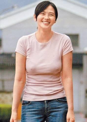 产后乳房下垂缩水