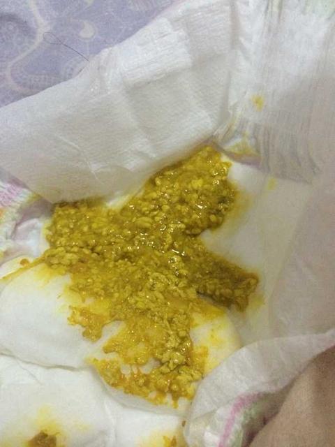 宝宝消化不良，妈妈应该这么做才对
