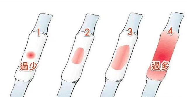 女性月经量多少正常