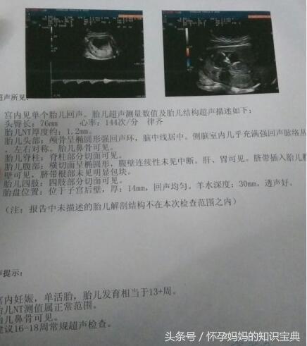 生男生女的方法