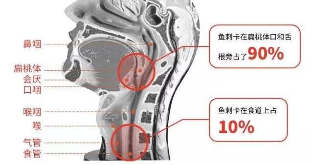 小孩为什么喜欢含饭不吞