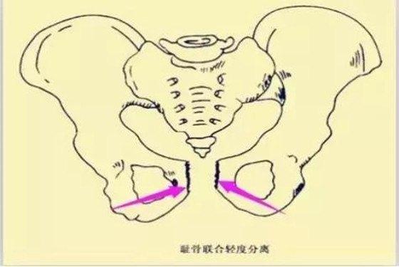 宝宝腹痛是什么原因引起的