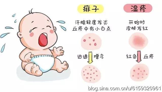 如何预防宝宝长痱子?