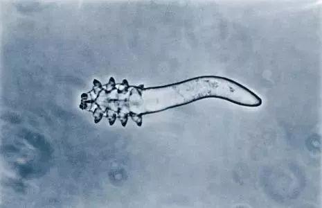 产褥感染的病因有哪些