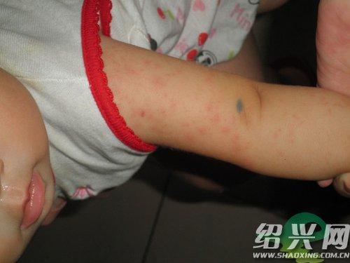 宝宝喝奶粉拉肚子怎么办?