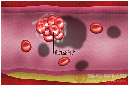 女性气血不足调好可以受孕吗