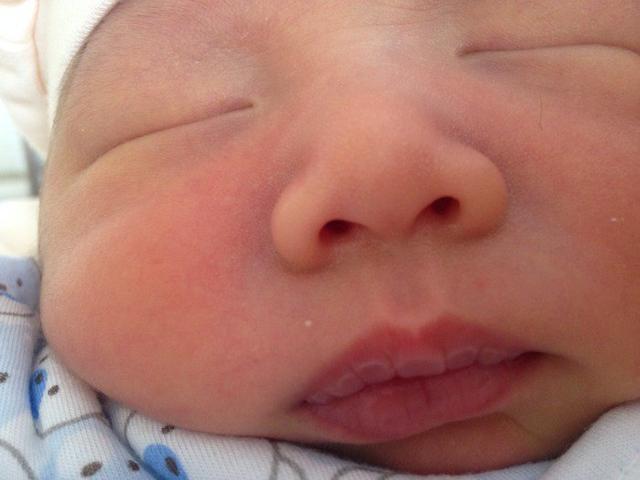 宝宝喝奶粉上火了怎么办