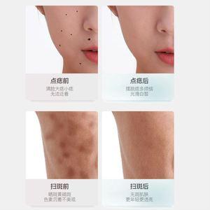 点痣笔脸部脂肪粒纹身抖音同款辅助针头定位扫斑笔新款祛痣仪器