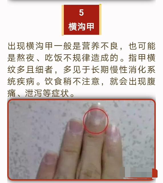 宝宝缺钙营养不良怎么办