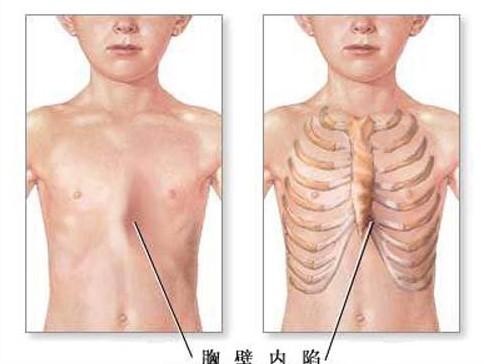 孩子缺钙怎么补效果好