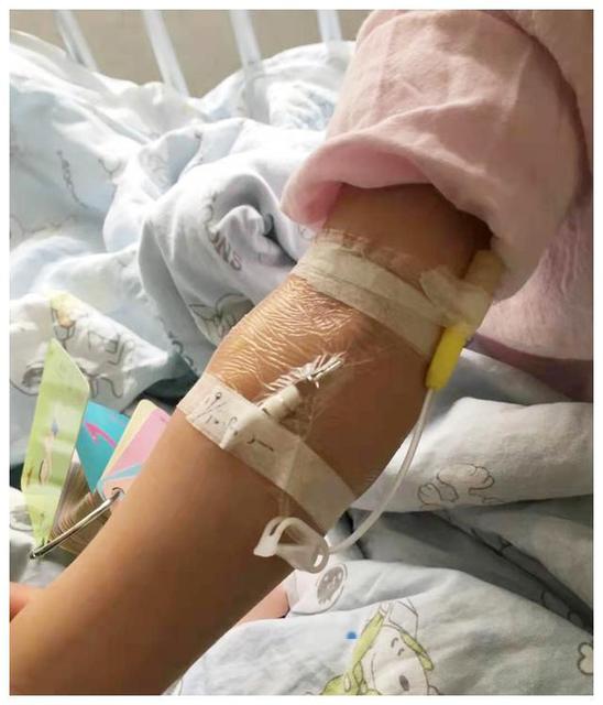 哪些孩子容易出现骨龄提前