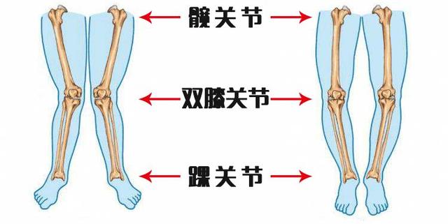 穿纸尿裤会导致宝宝o型腿吗