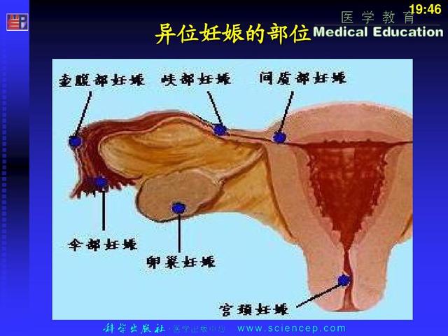 妊娠反应什么时候开始