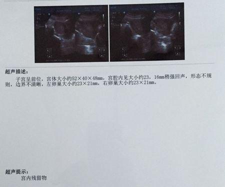 孕囊小于1cm能药流吗