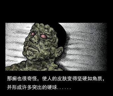 【天津怪藓】相关长尾关键词有哪些