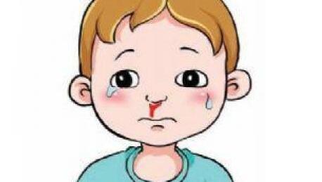 儿童经常流鼻血是上火了吗