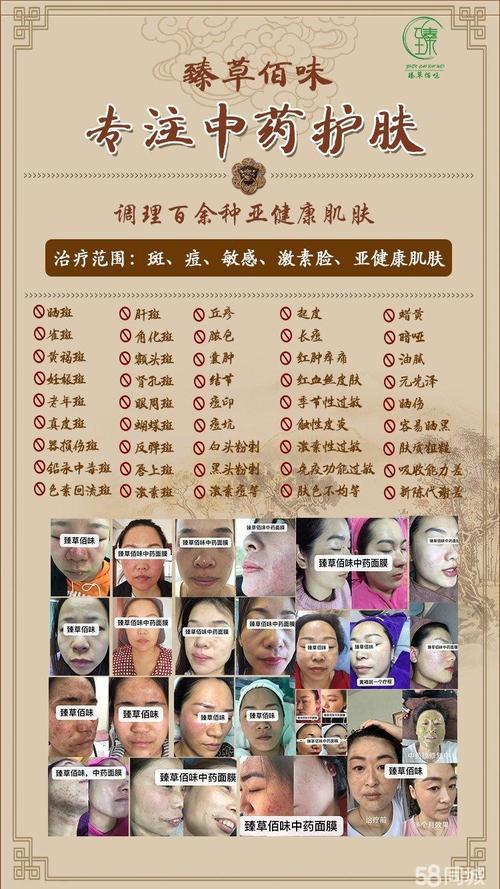 面膜加盟民宿家具工厂【臻草佰味中药面膜加盟】臻草佰味中药面膜加盟条件